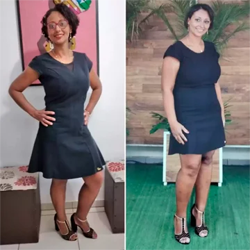Antes e depois de Ester B.