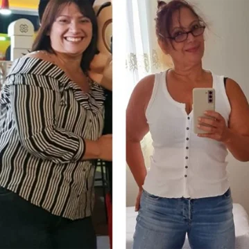 Antes e depois de Kathy E.