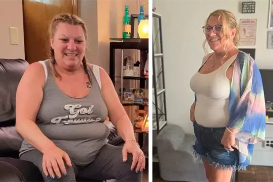 Antes e depois de Nalva G.