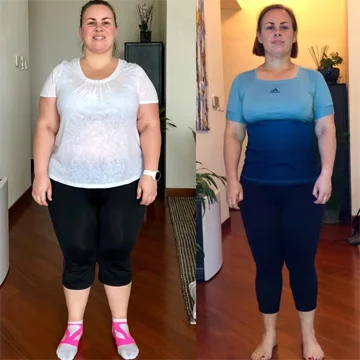 Antes e depois de Tereza S.